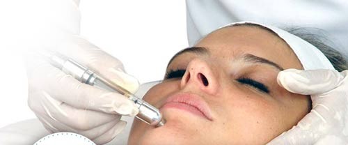 Higiene facial profunda con punta de diamante